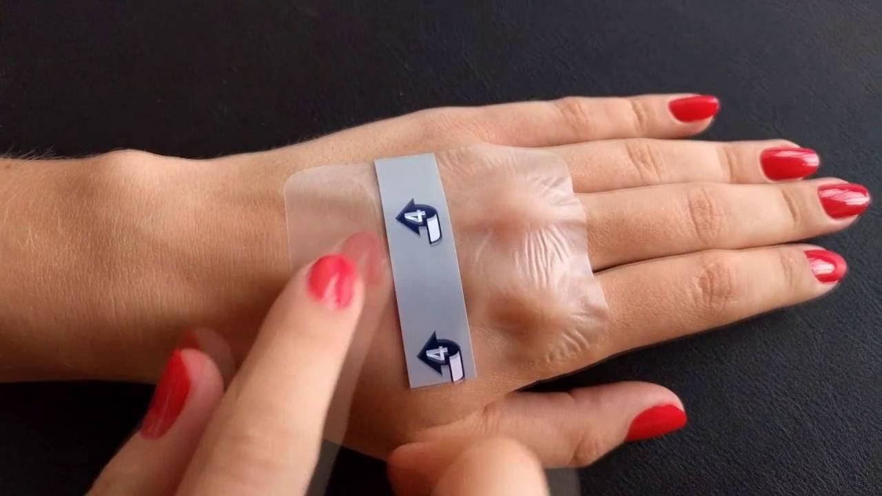 Создали повязку, которая сама диагностирует бактериальные инфекции Создали повязку, которая сама диагностирует бактериальные инфекции