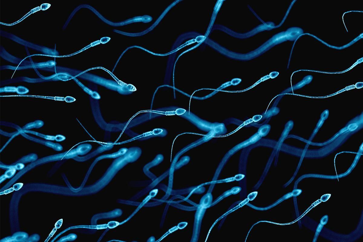 Спермограмма: как подготовиться, сдать и понять анализ