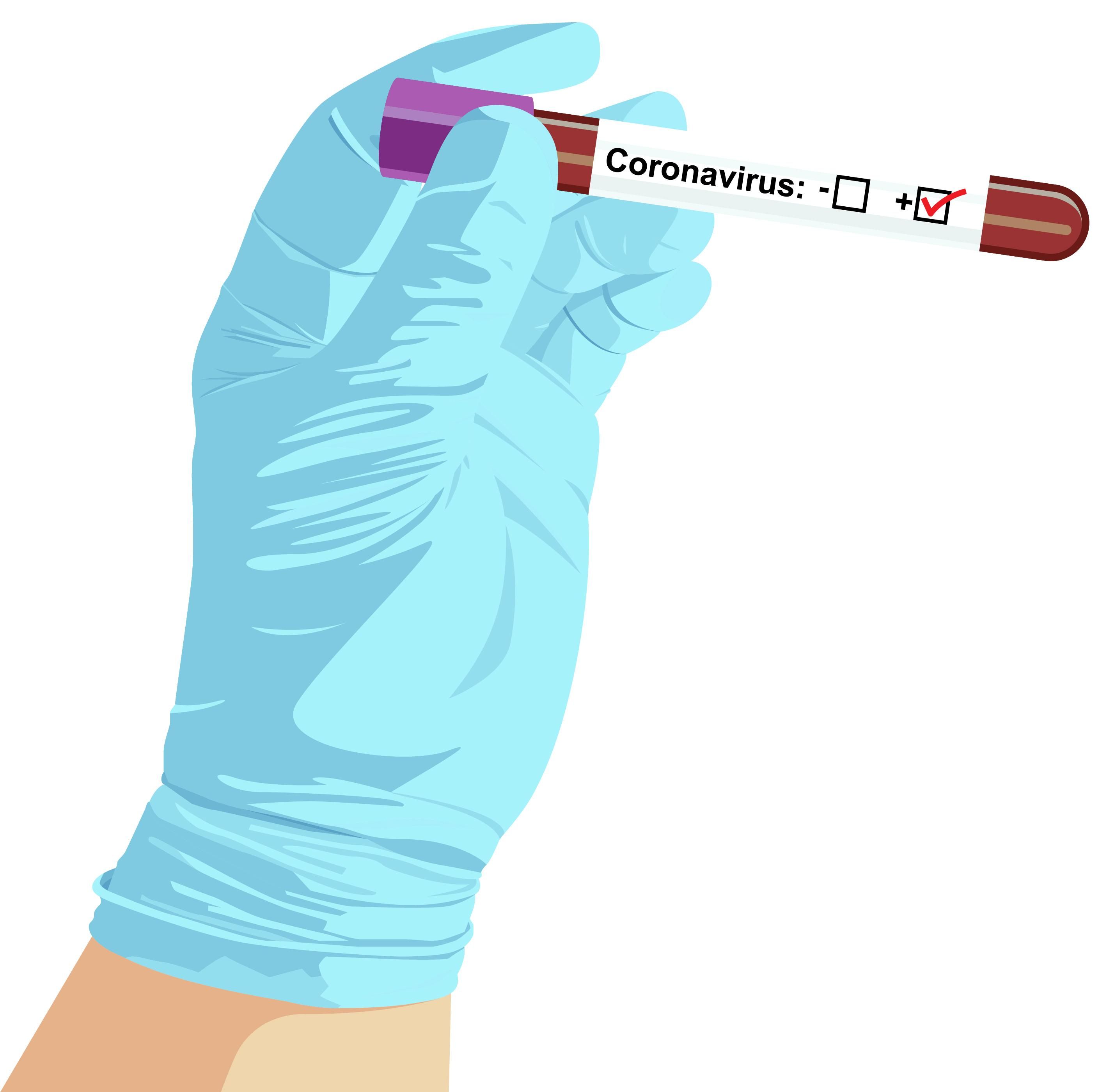 Україна отримала тест-систему для виявлення коронавірусу