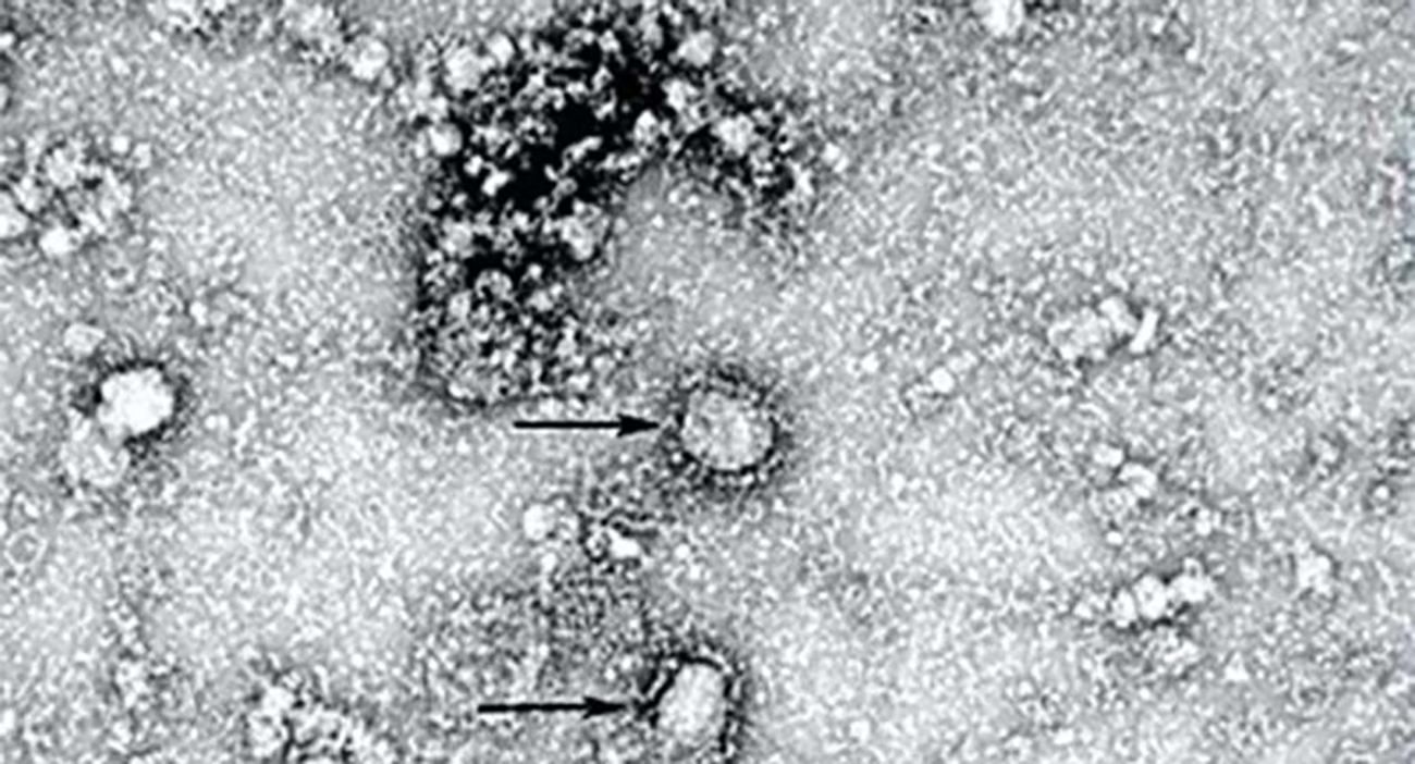 ВООЗ надав офіційну назву китайському коронавірусу