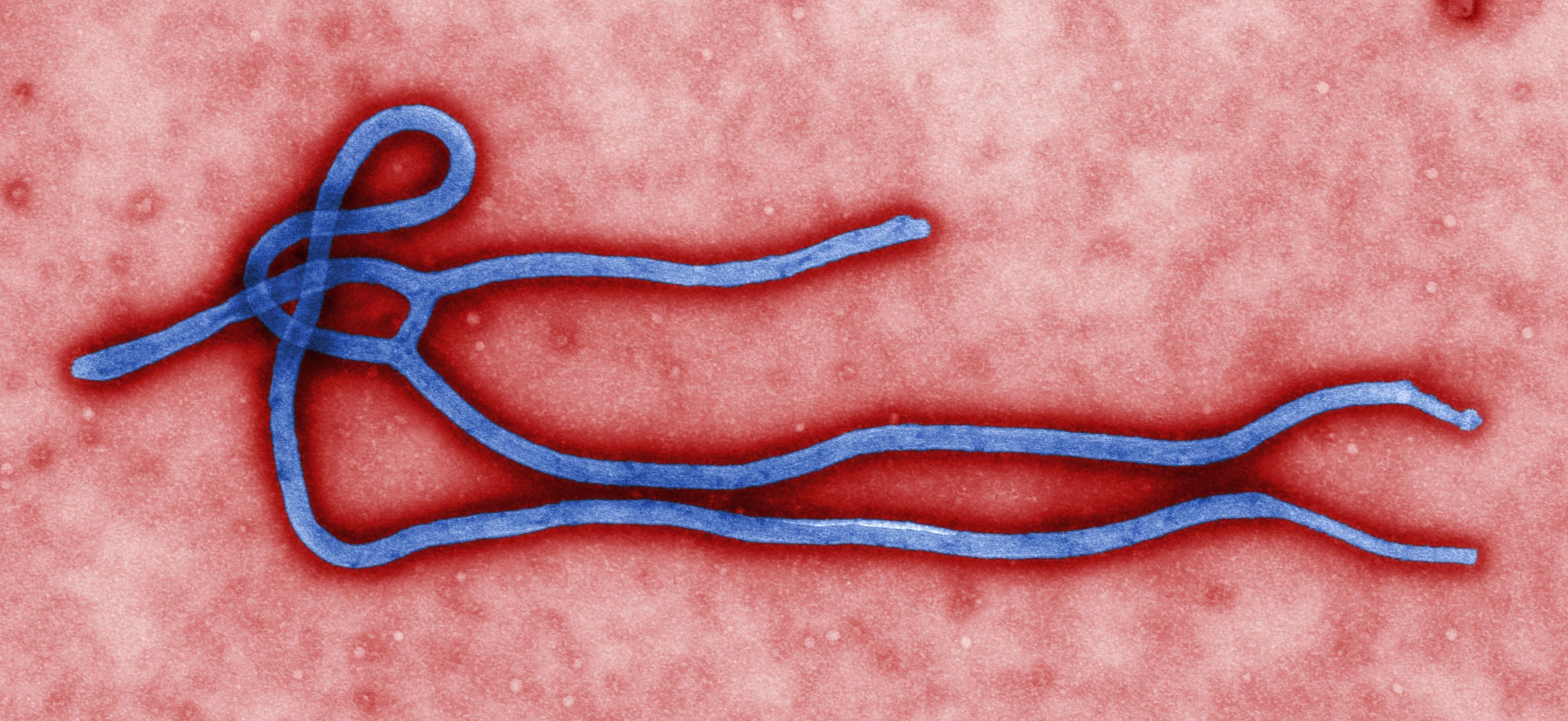 Ген вірусу Ебола може допомогти у лікуванні раку мозку