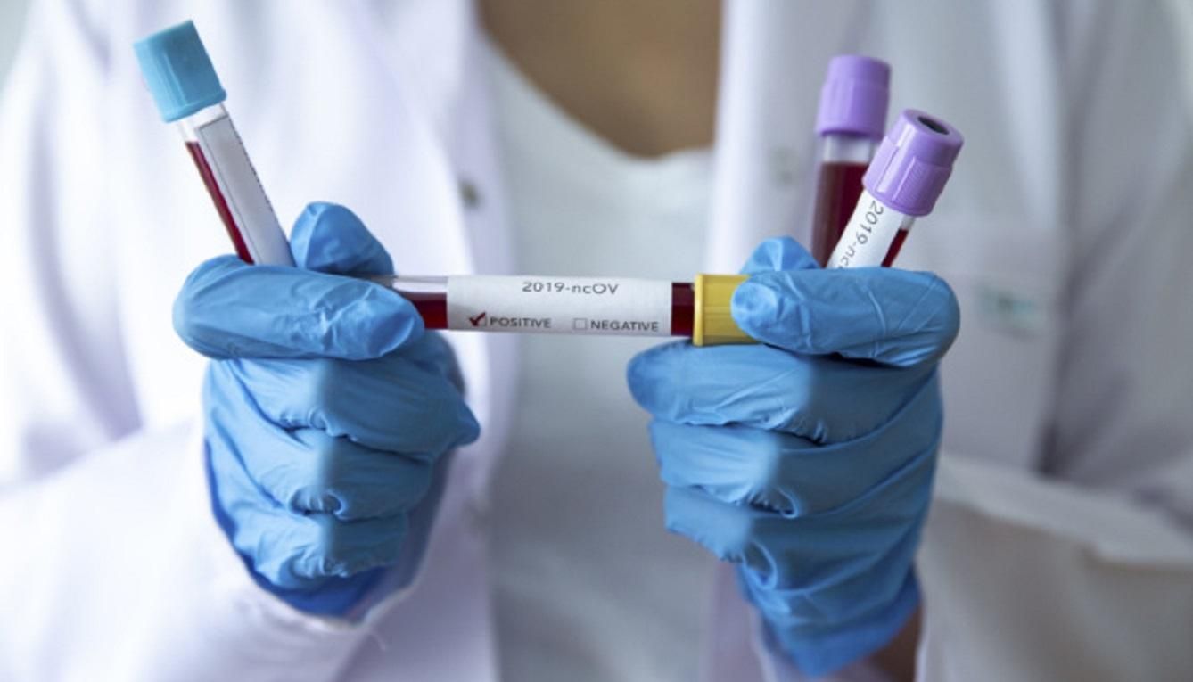 Коронавирус в Италии: число зараженных перевалило за сотню Коронавирус в Италии: число зараженных перевалило за сотню