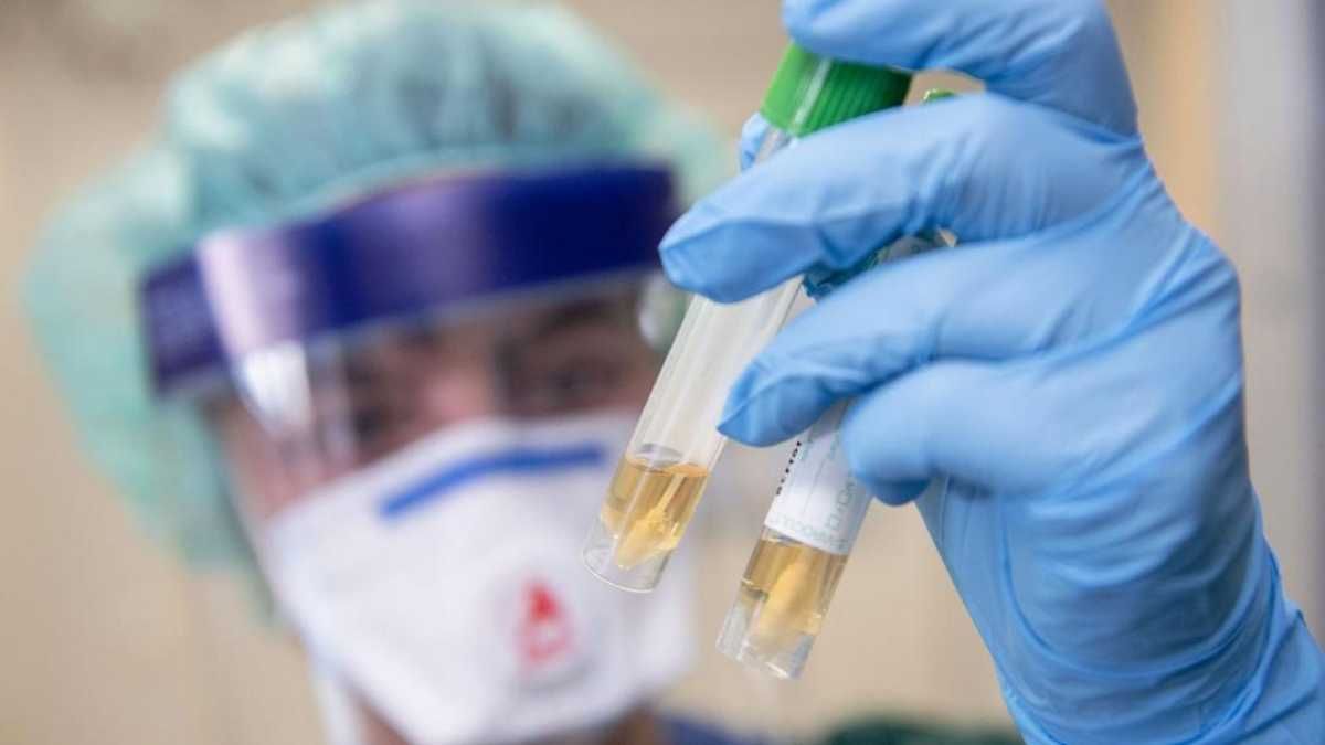 Сколько тестов на выявление коронавируса сейчас есть в Украине