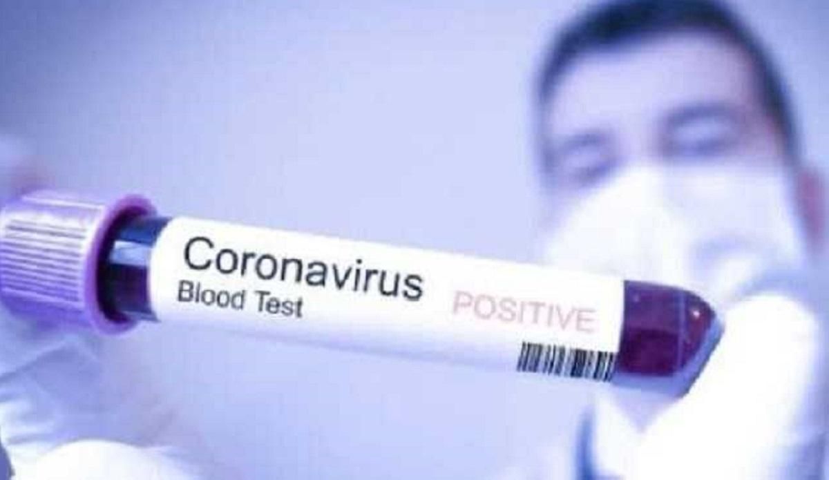 У Білорусі коронавірус підозрюють у ще однієї людини