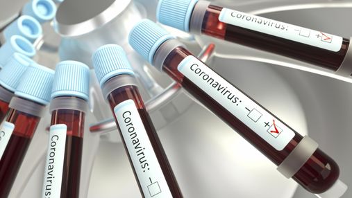Украина получит экспресс-тесты для выявления коронавируса за 15 минут