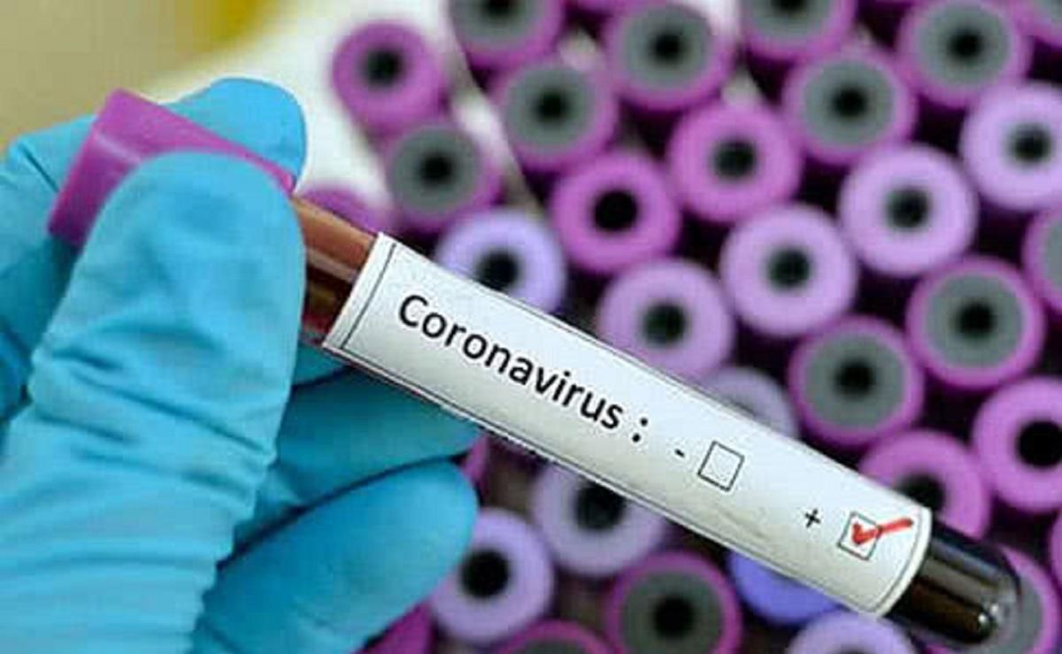 В Чехии зафиксировали первые случаи заражения коронавирусом