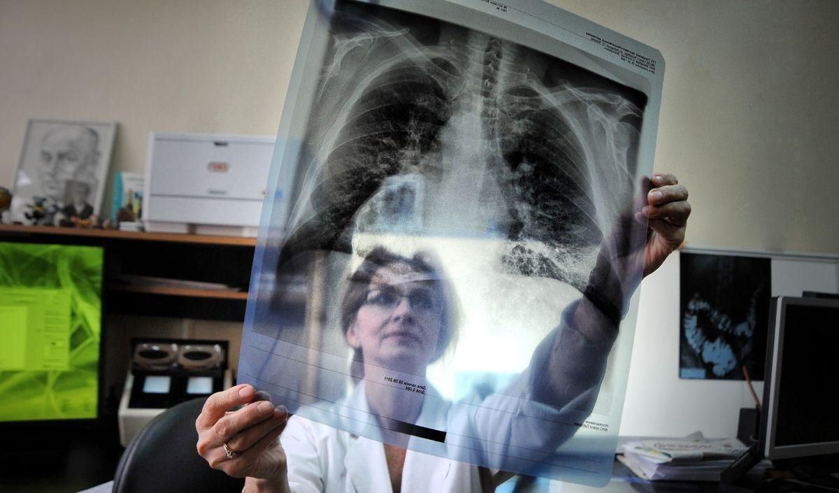 Супрун пояснила, чому впроваджують зміни у лікуванні хворих на туберкульоз
