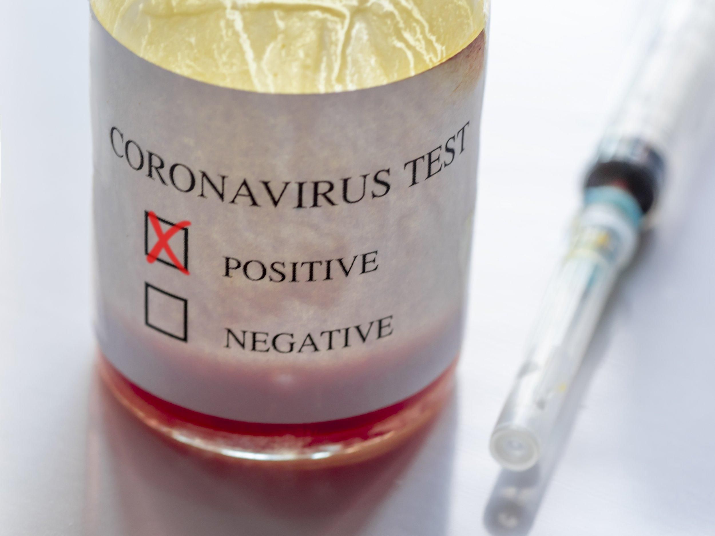 У хворих на коронавірус лікарі виявили нові симптоми 