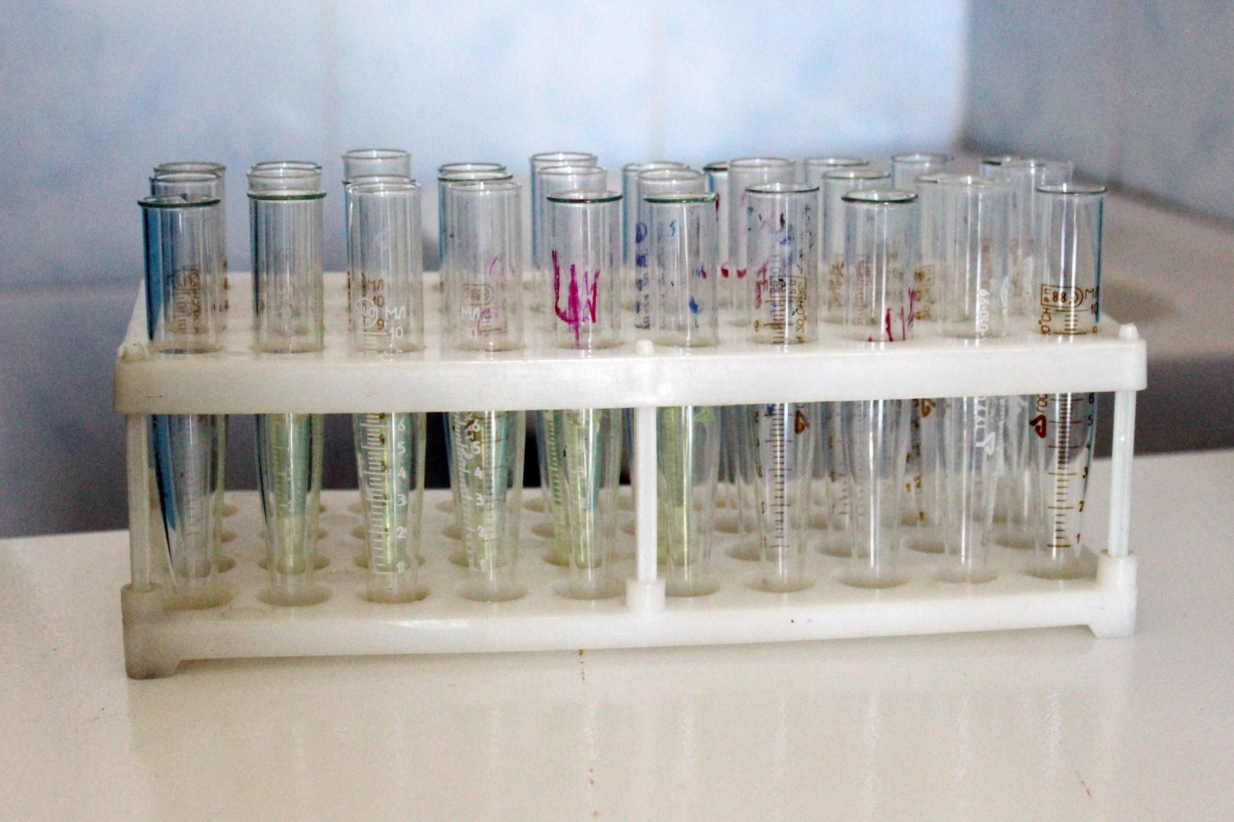 В Україні одужав перший хворий від коронавірусу В Україні одужав перший хворий від коронавірусу