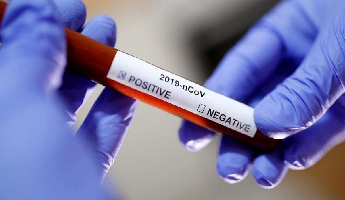 В Україні підтвердили 24 нові випадки зараження коронавірусом