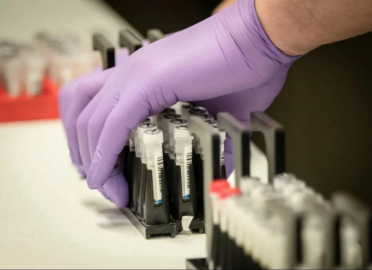 Центр громадського здоров'я отримав перші тест-системи для коронавірусу