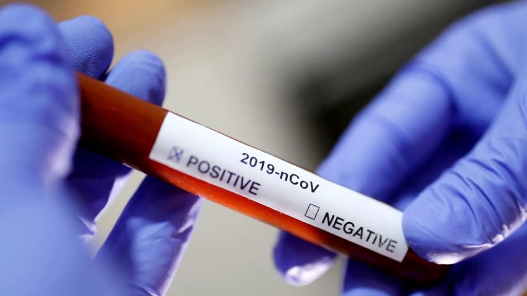 У Запоріжжі вже 8 людей захворіли на коронавірус: деталі