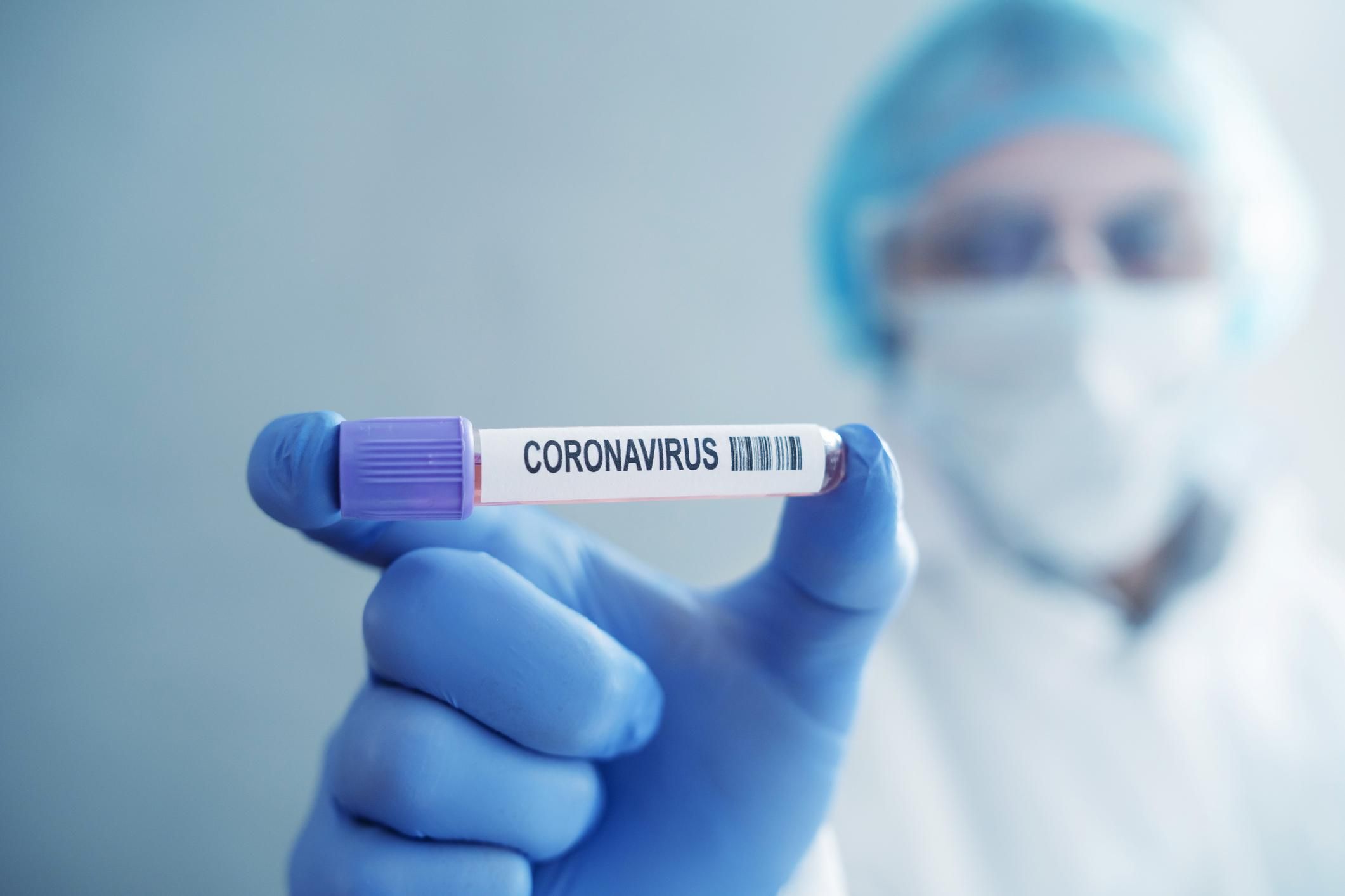 На Сумщине впервые зафиксировали коронавирус