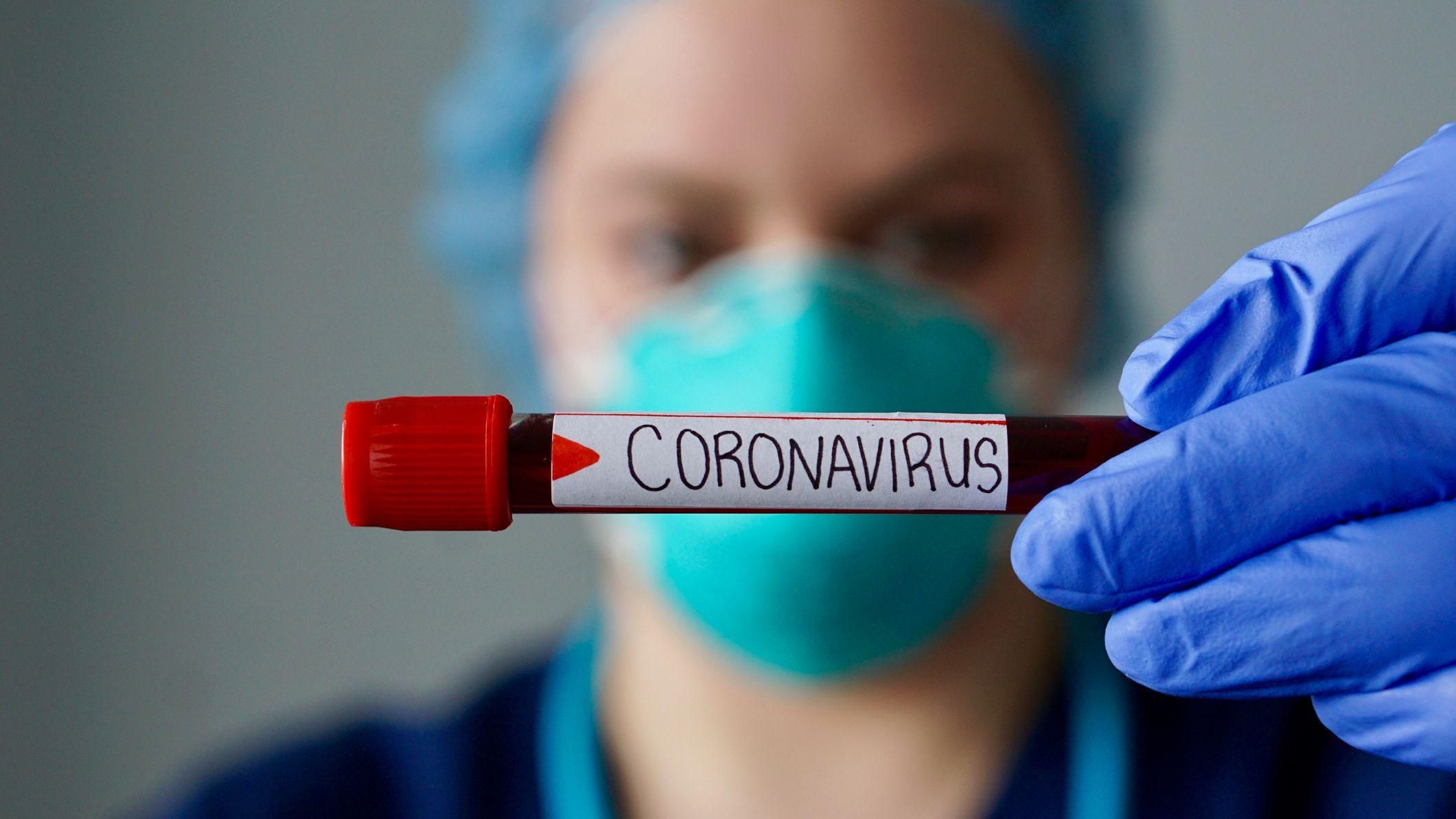 На Сумщині зареєстрували ще 3 випадки коронавірусу: деталі