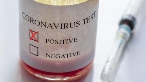 Майже 400 українців лікуються від коронавірусу вдома, – Ляшко