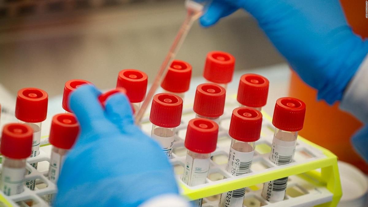 З наступного тижня українські тест-системи на коронавірус будуть у лабораторіях, – МОЗ