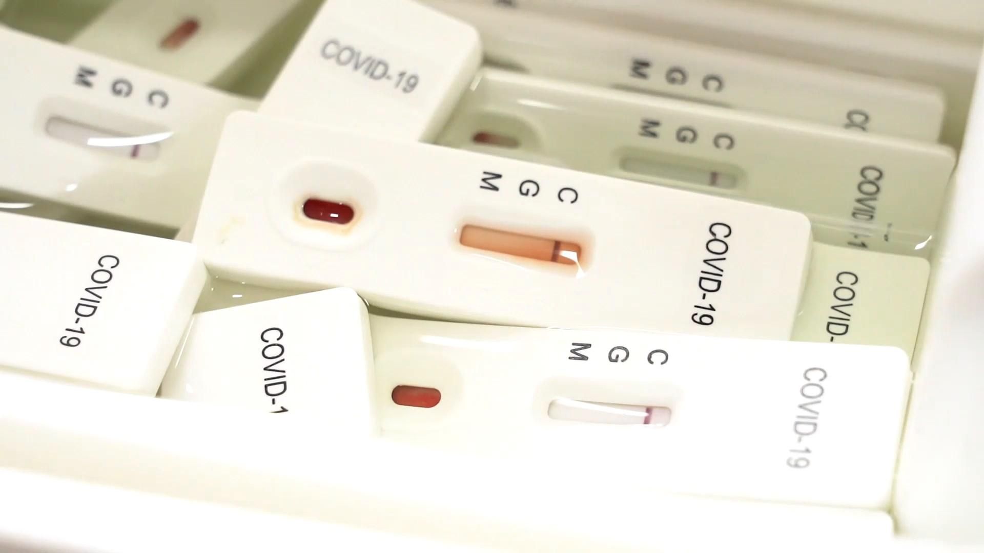 Украина – в лидерах антирейтинга по тестированию на COVID-19: детали Украина – в лидерах антирейтинга по тестированию на COVID-19: детали