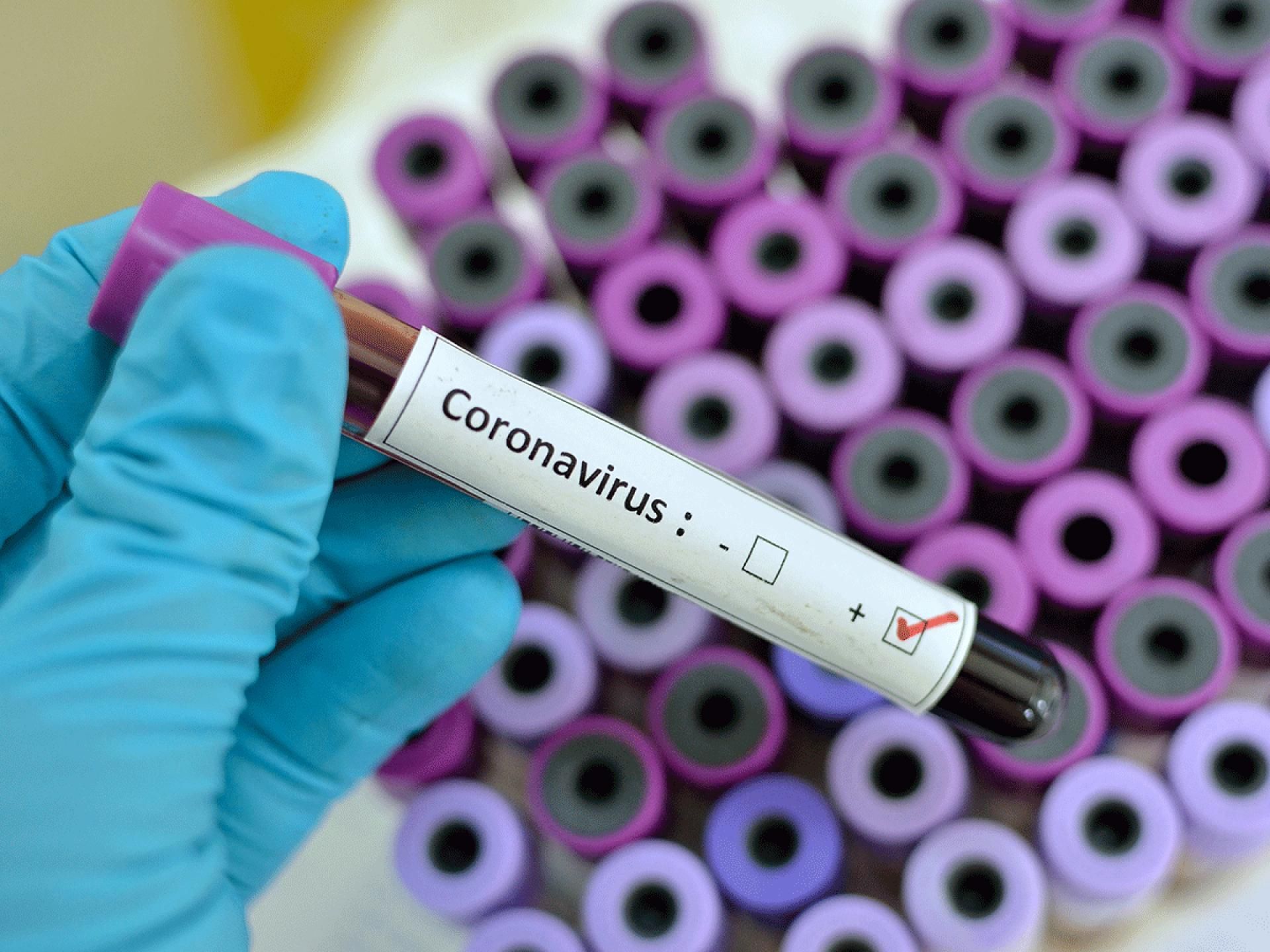 Вспышка коронавируса на Тернопольщине: инфицировано 22 человека из дома престарелых