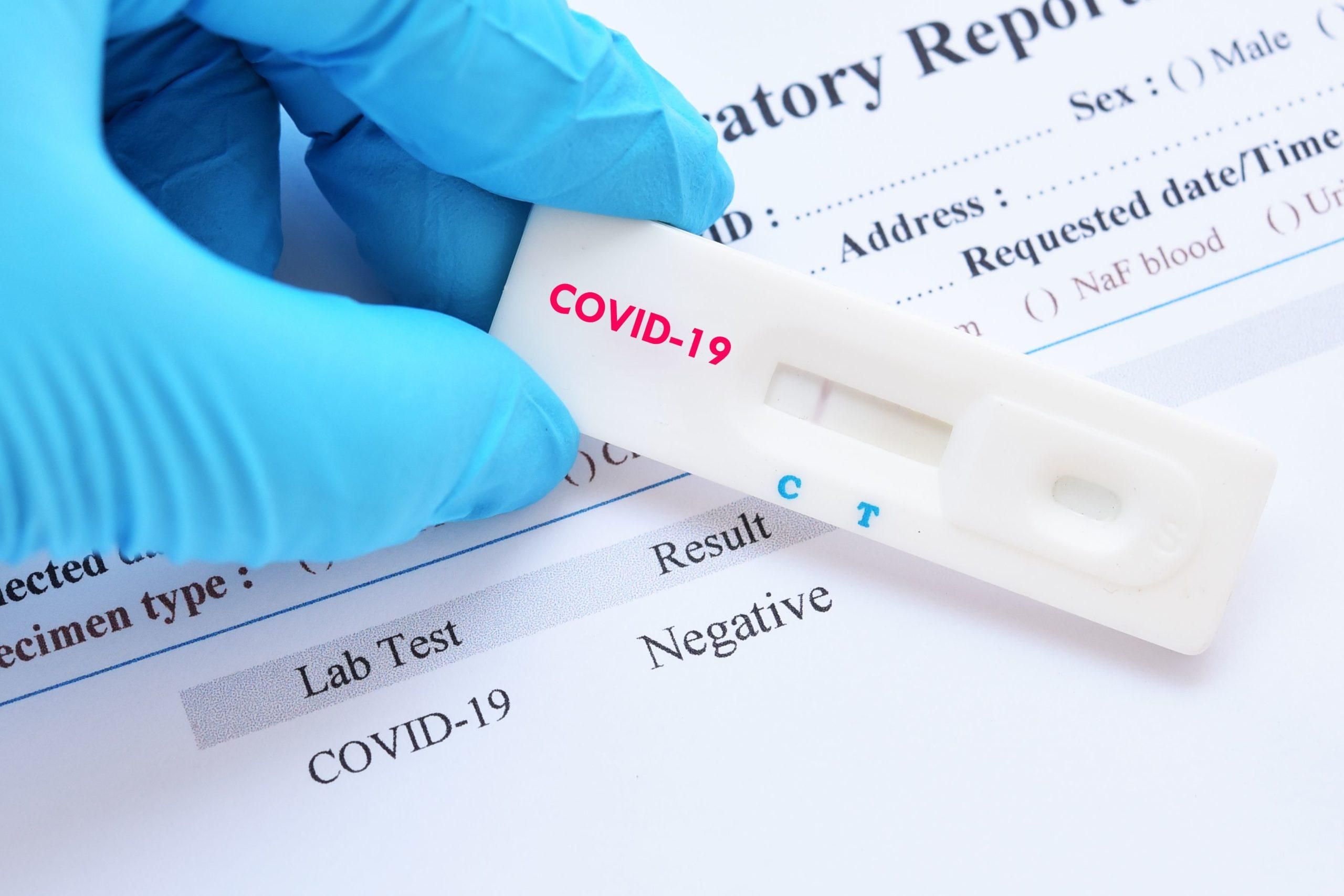 У США  схвалили тести на коронавірус для самостійного використання