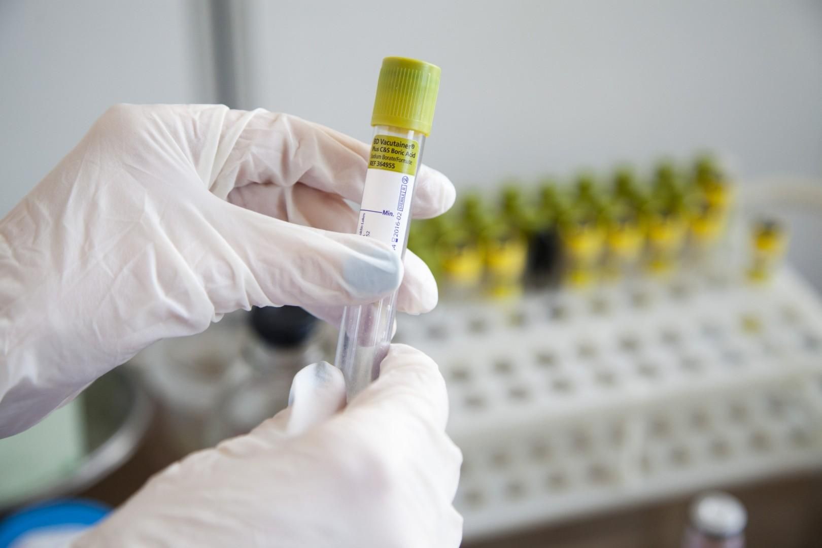 В Німеччині почали випробувати вакцину проти коронавірусу на людях