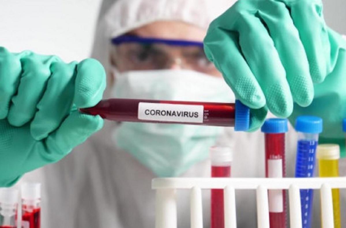У запорізькому гуртожитку – спалах коронавірусу: тестують усіх контактних осіб