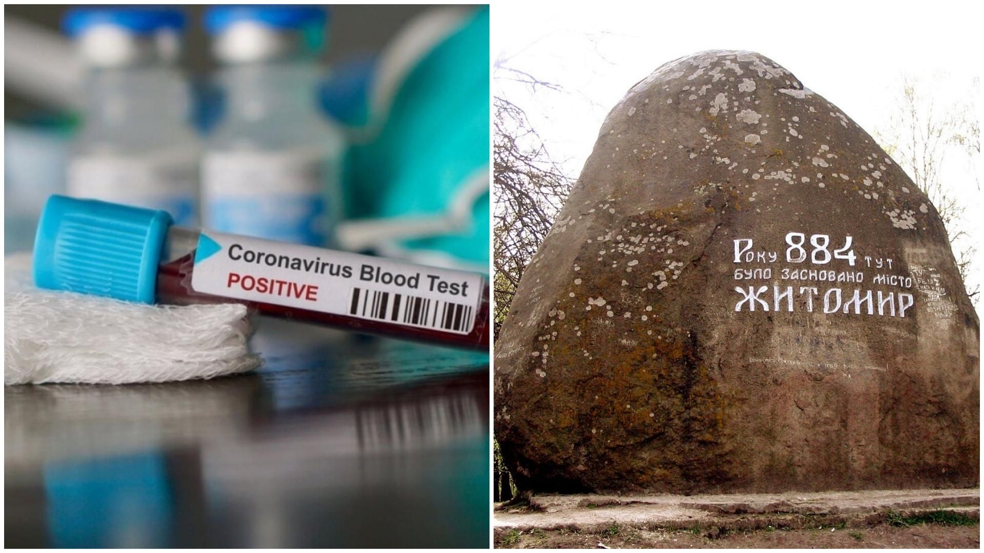 Коронавірус у Житомирській області: останні новини