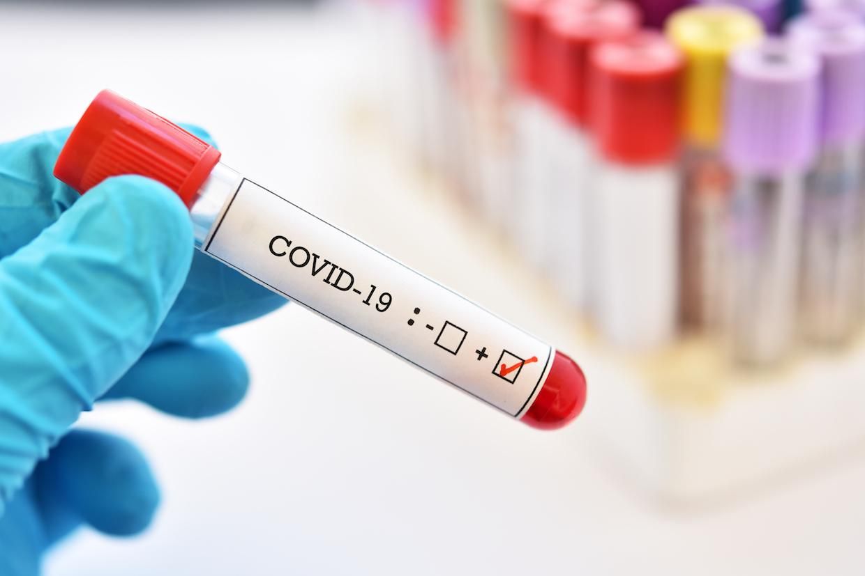 Спалах коронавірусу на Волині: в ОДА пояснили причину