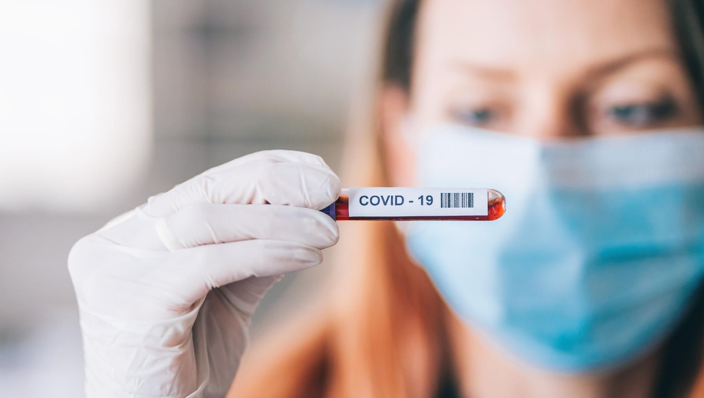 Ученые прогнозируют спад эпидемии COVID-19 в Украине в конце мая