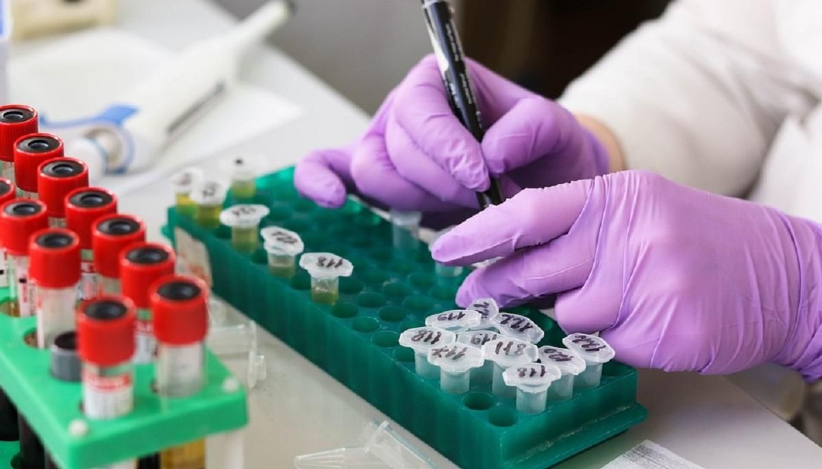 У 3 областях України одужали вже три чверті хворих на коронавірус: цікава статистика У 3 областях України одужали вже три чверті хворих на коронавірус: цікава статистика