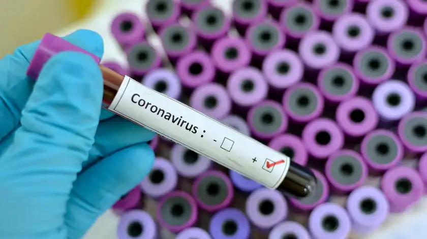 У Франції стоматологи вимагають від пацієнтів пройти тест на коронавірус