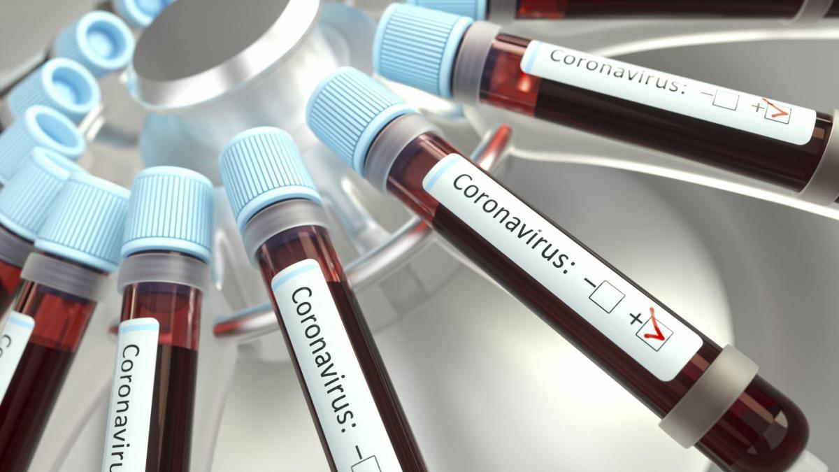 В Охматдит передали тести на виявлення коронавірусу
