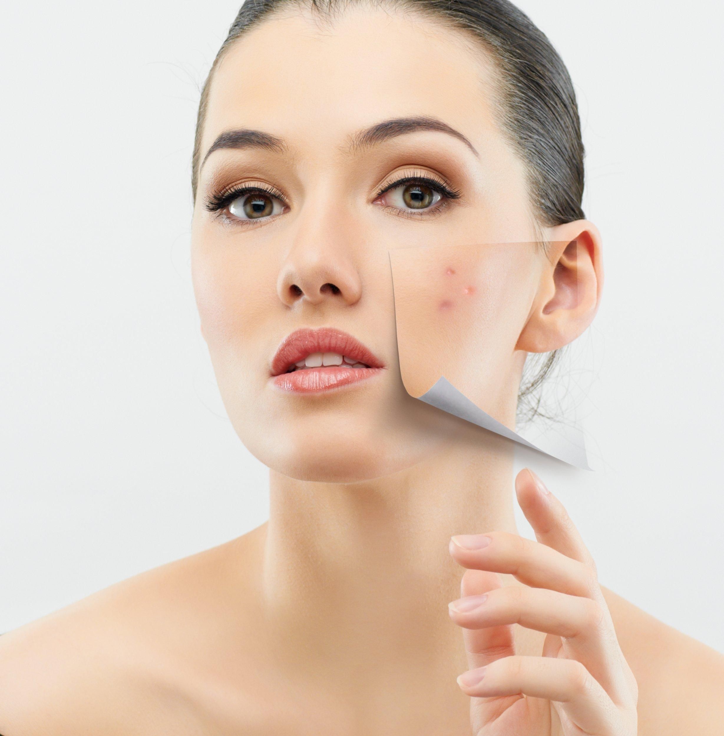 COVID-19 может вызвать изменения кожи: 5 известных симптомов