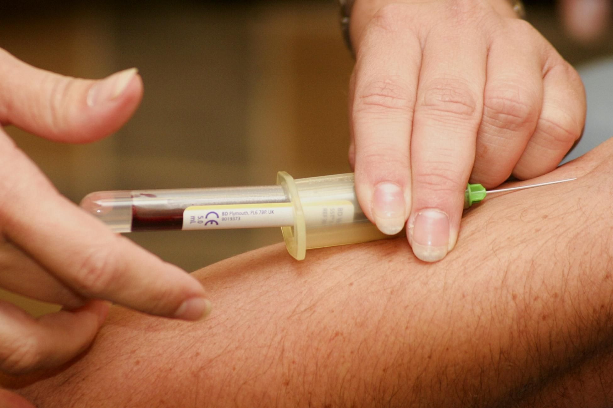 Рада приняла законопроект об оптимизации службы крови: что это значит