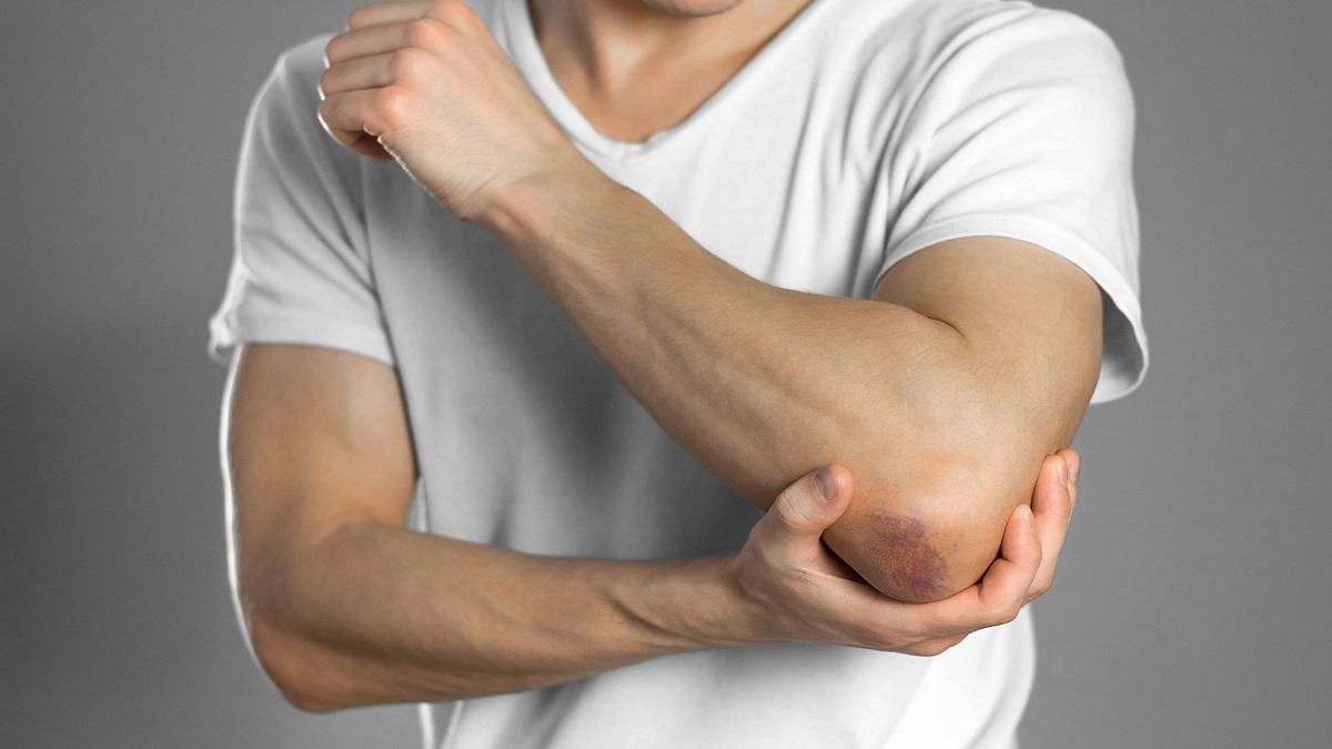  Забиття, розтягнення або розрив м'язів: як лікувати
