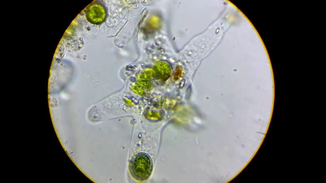 Питается мозгом человека: у мужчины зафиксировали редкую амебу Питается мозгом человека: у мужчины зафиксировали редкую амебу