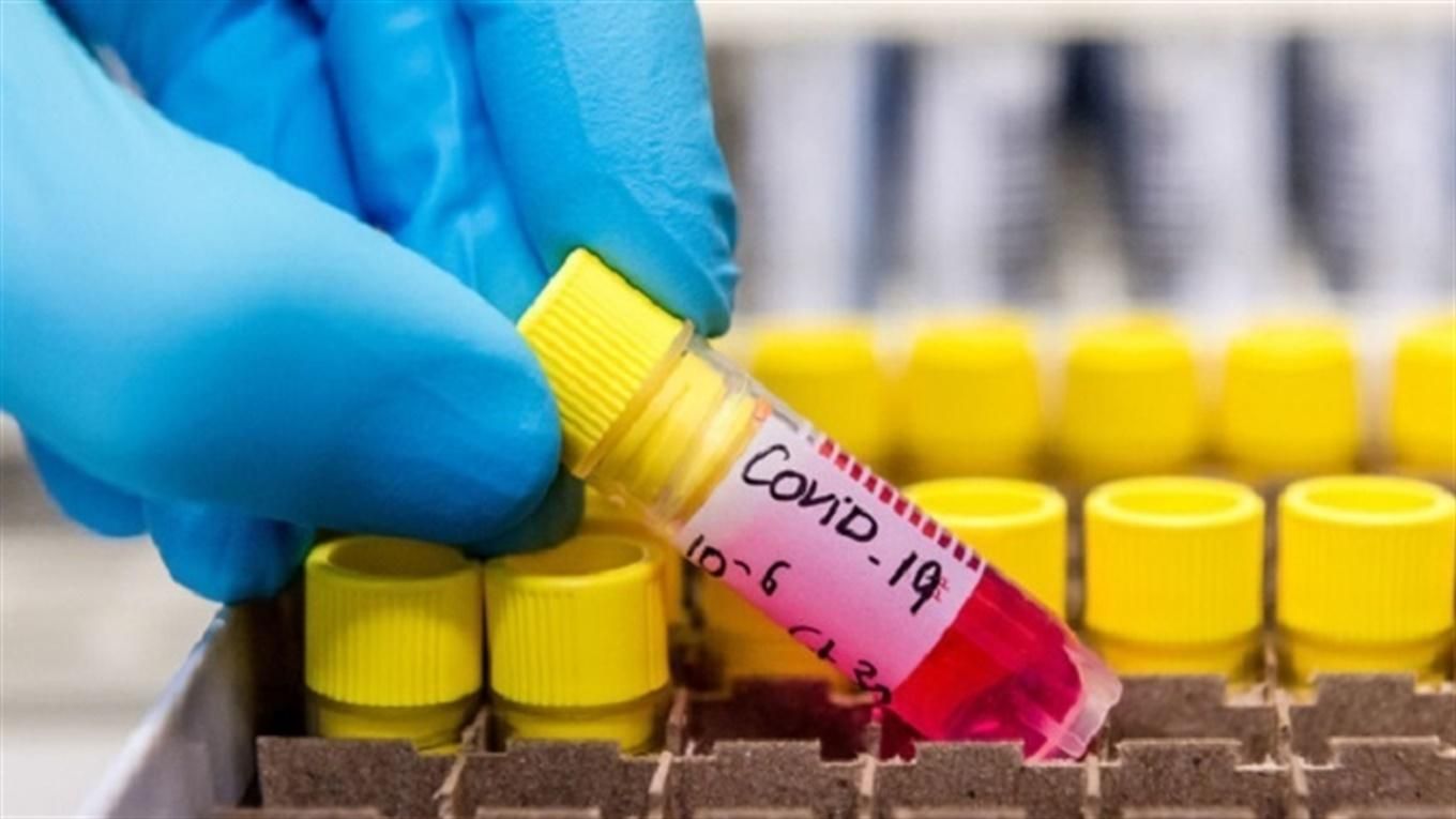 Коронавірус знайшли у крові донора, який давно одужав