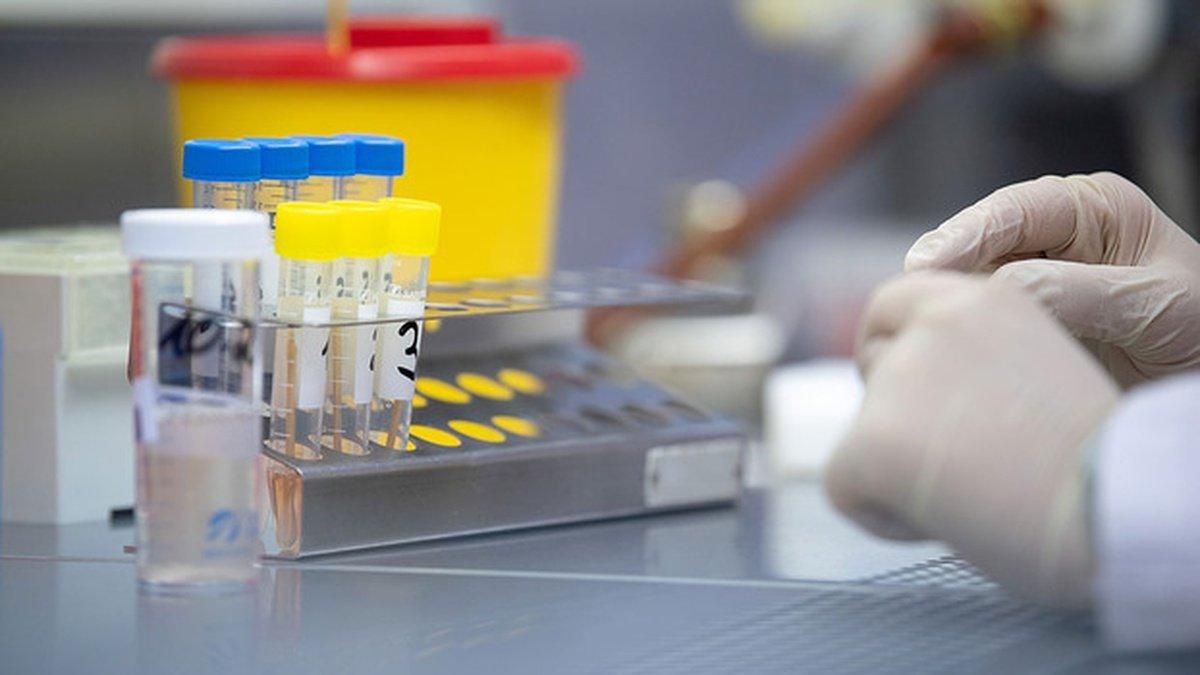 Боротьба із COVID-19: історія хвороби українця Боротьба із COVID-19: історія хвороби українця