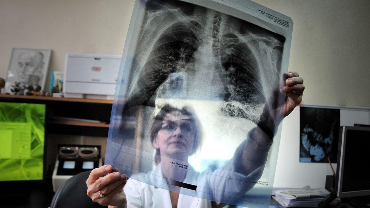 Відкрили механізм самознищення туберкульозу