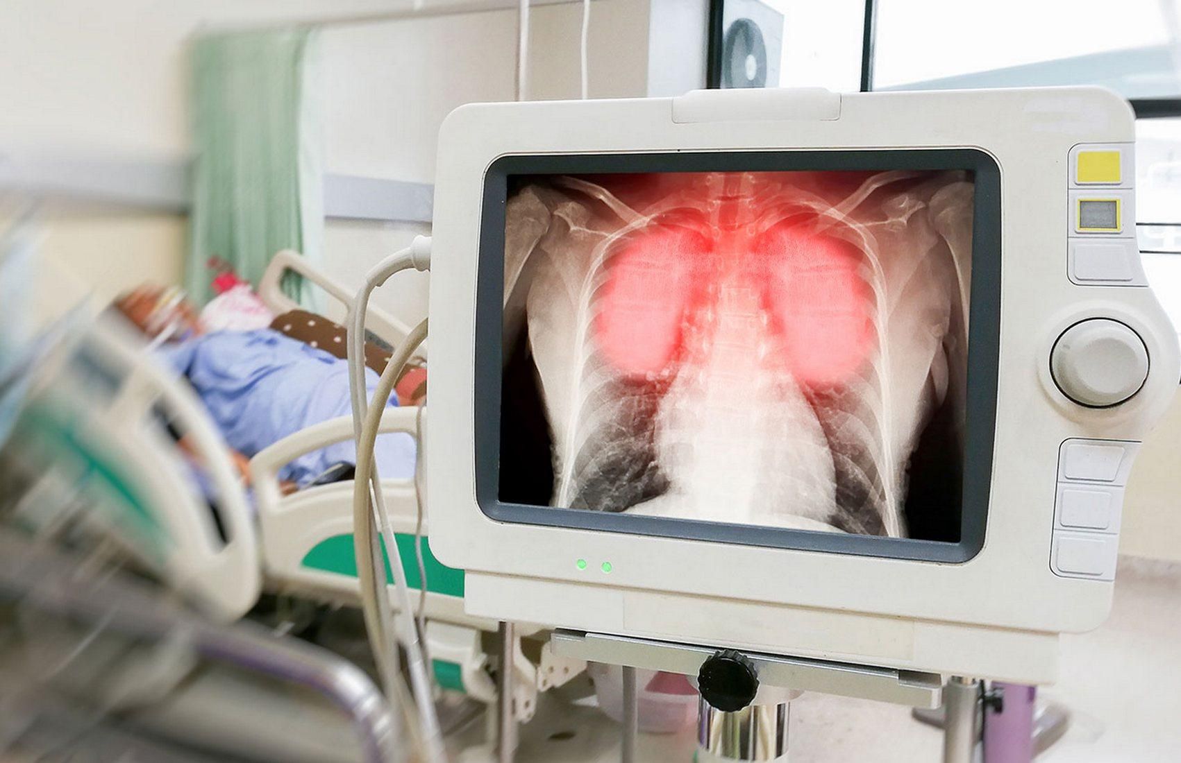 Пандемия набирает обороты: ВОЗ зафиксировала наибольшее количество новых случаев COVID-19 Пандемия набирает обороты: ВОЗ зафиксировала наибольшее количество новых случаев COVID-19