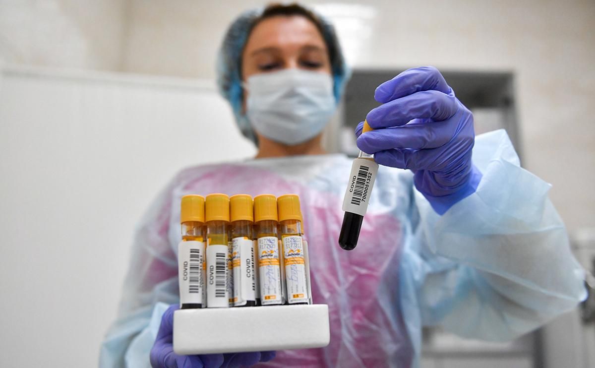 В Украине более 73 тысяч человек заболели коронавирусом: статистика в областях В Украине более 73 тысяч человек заболели коронавирусом: статистика в областях