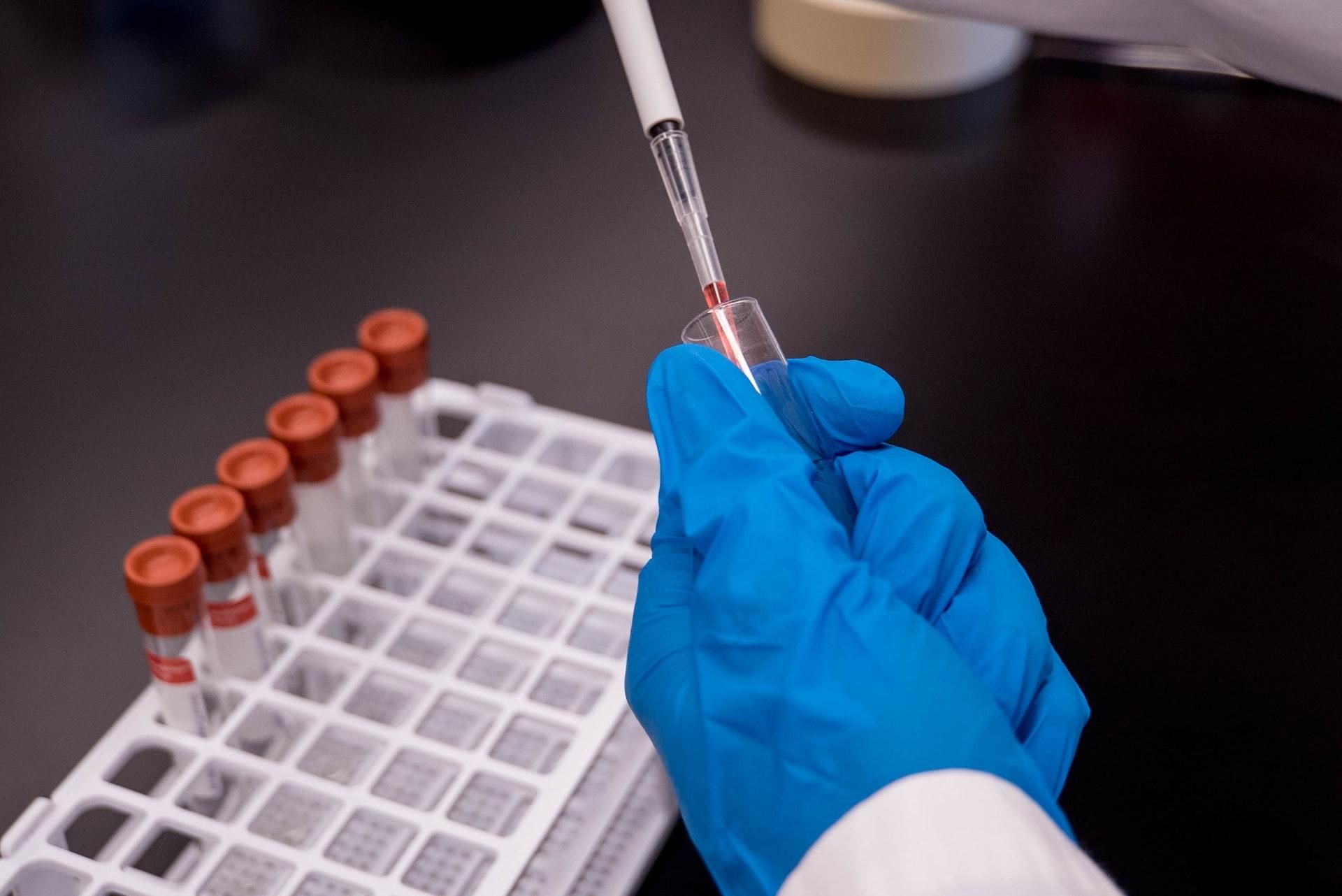 Тестування на коронавірус: з'явились нові рекомендації 