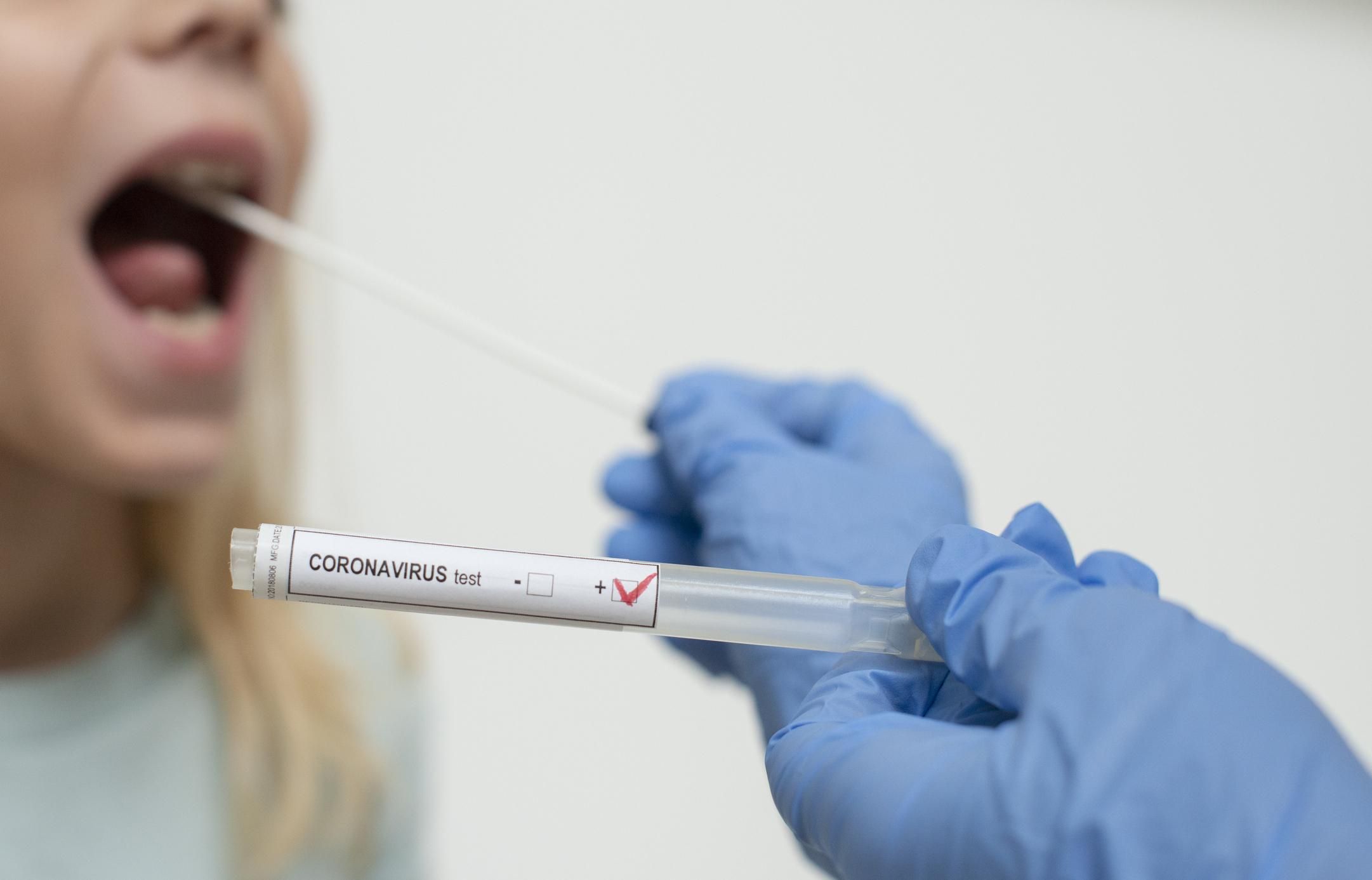 Як підготуватися до ПЛР-тесту на коронавірус