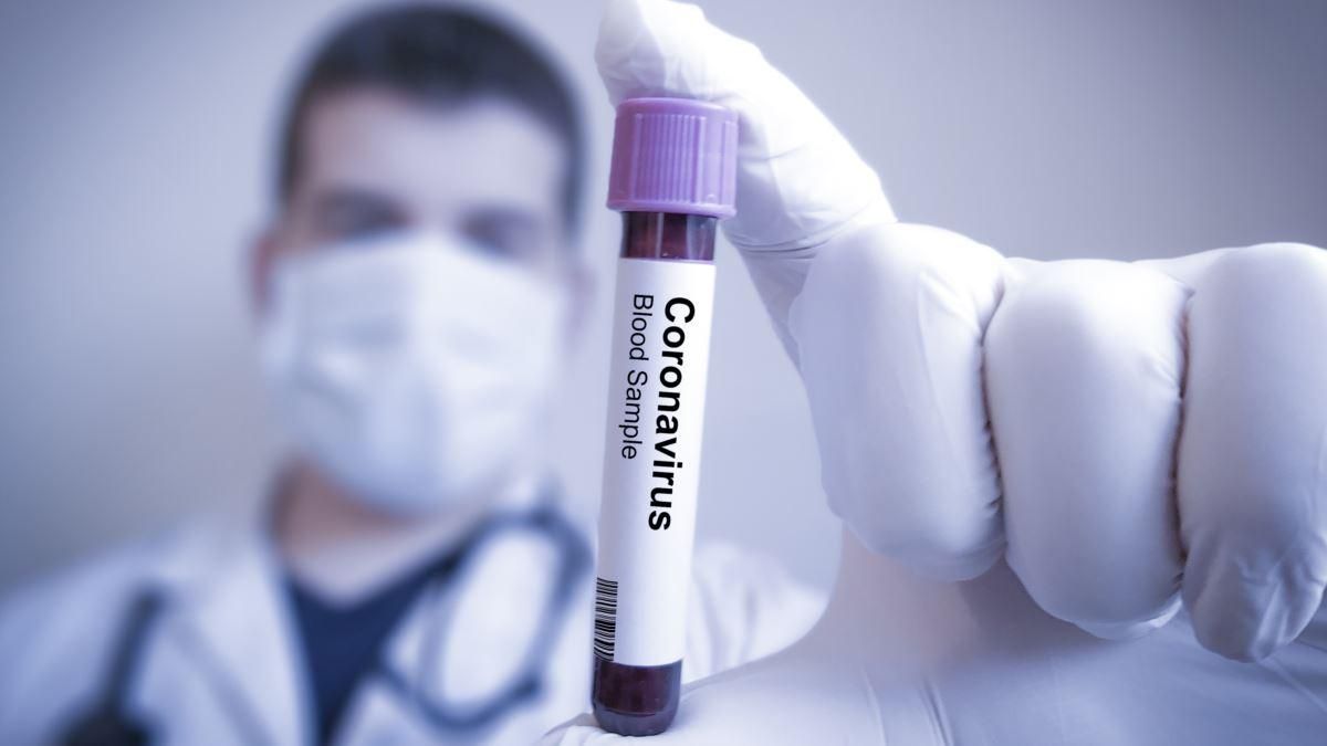 "Навіть мавпам не дамо": у США різко висловилися у бік російської вакцини проти COVID-19