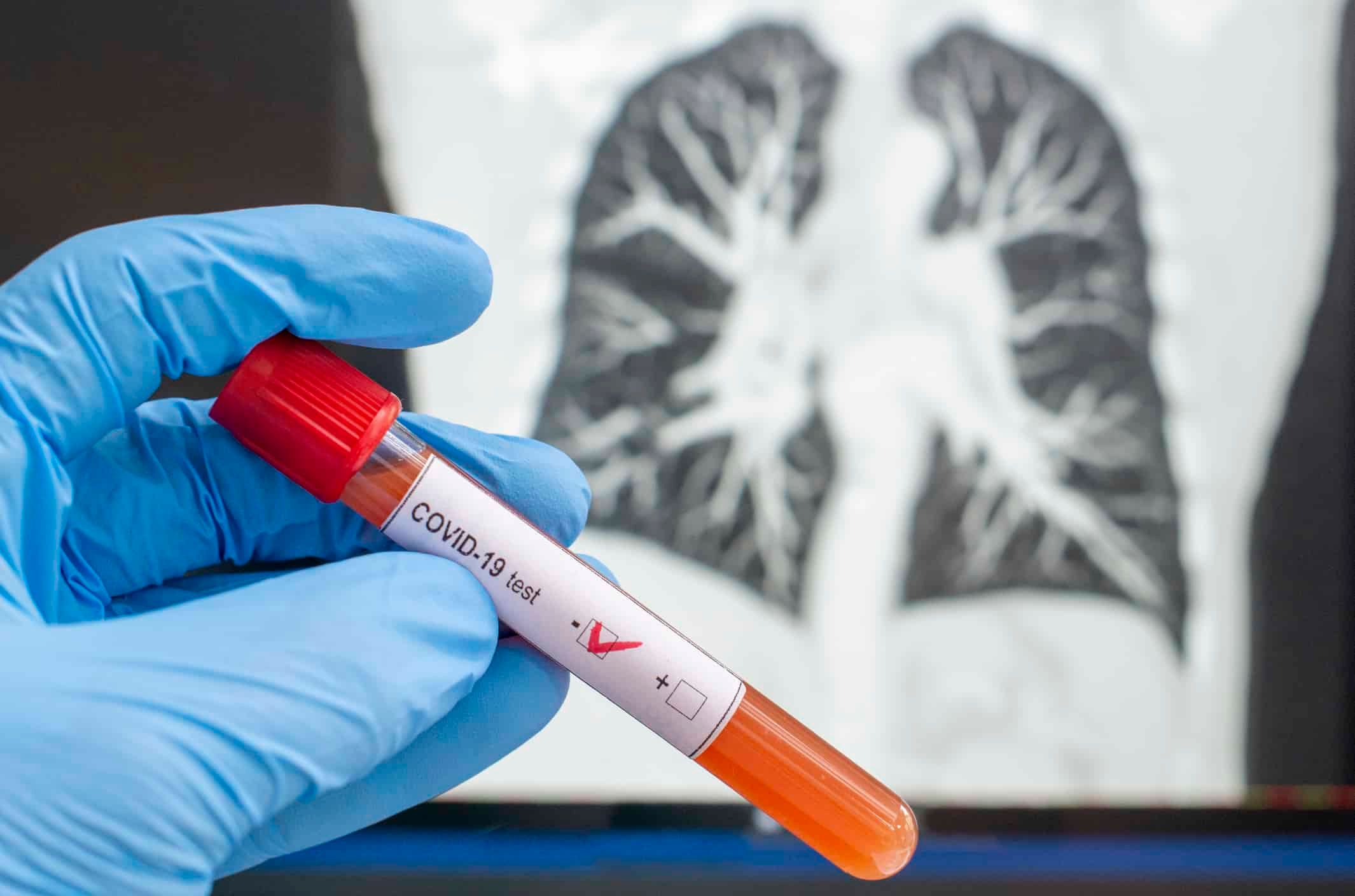 Почти 2 тысячи больных: в Украине очередной рекорд Почти 2 тысячи больных: в Украине очередной рекорд