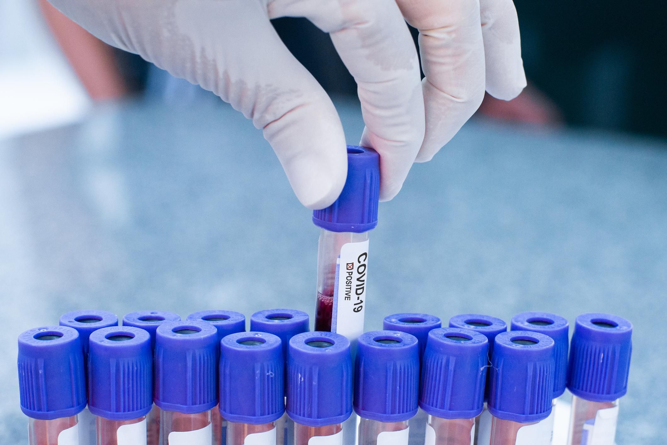 Греция будет бесплатно выдавать вакцину от коронавируса Греция будет бесплатно выдавать вакцину от коронавируса