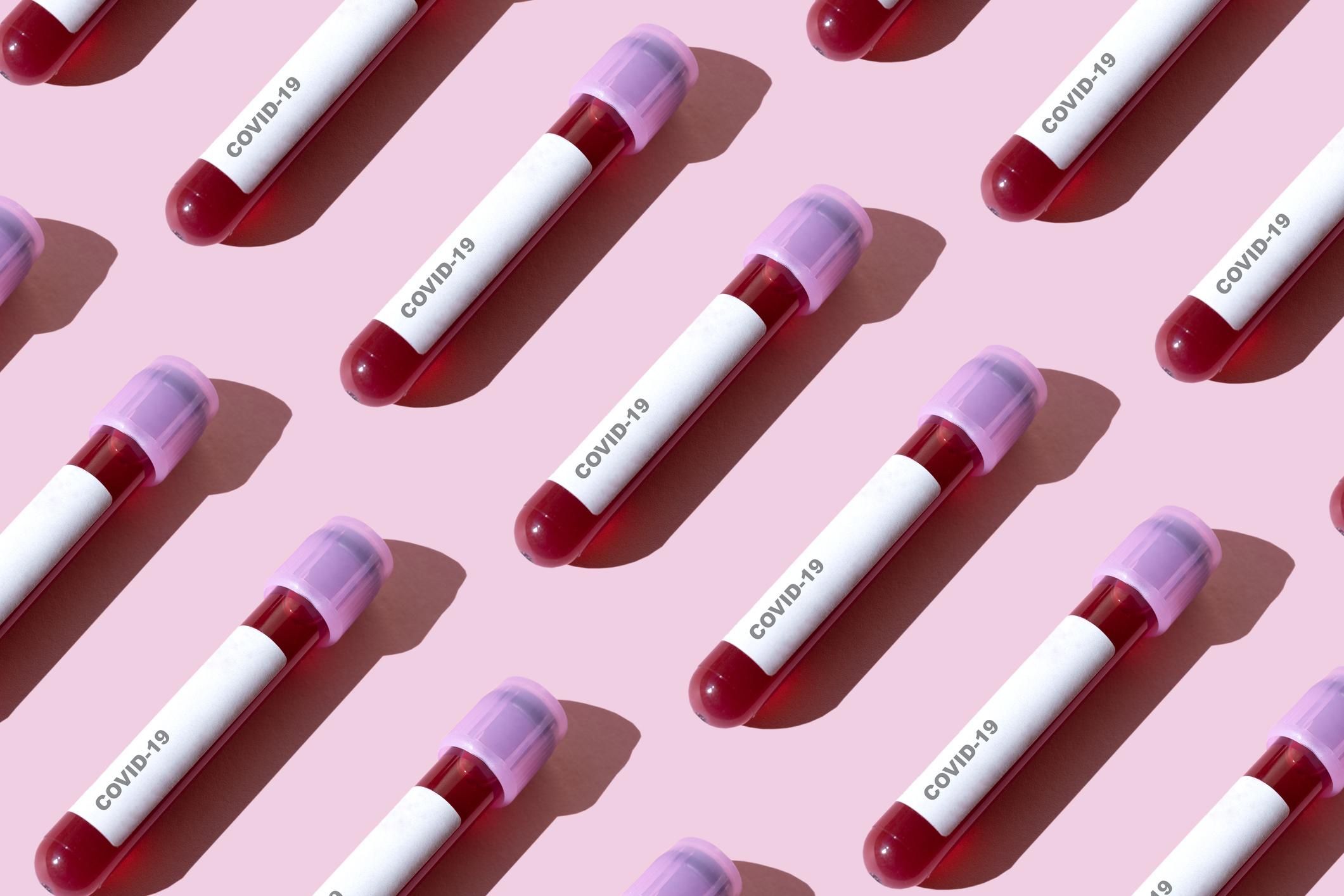 В Ізраїлі розробили 10-секундний тест на коронавірус, який може з'явитися в Україні В Ізраїлі розробили 10-секундний тест на коронавірус, який може з'явитися в Україні