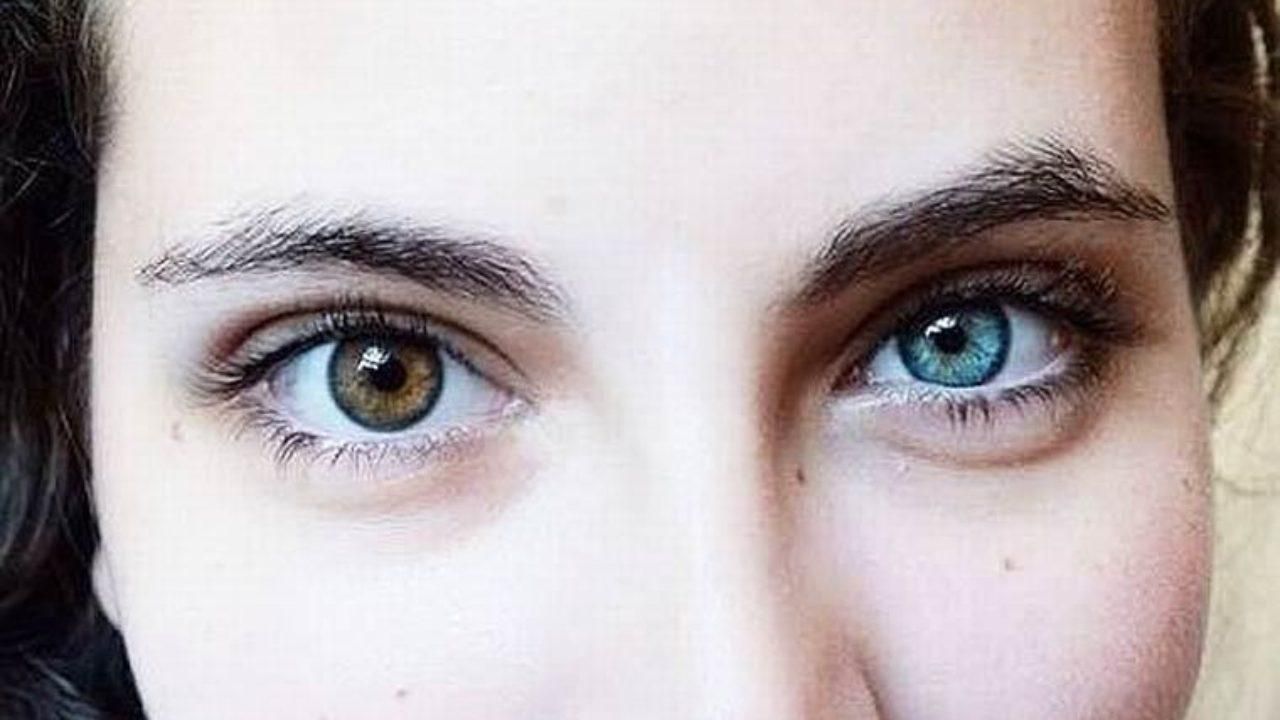 Різний колір очей: що таке гетерохромія у людей