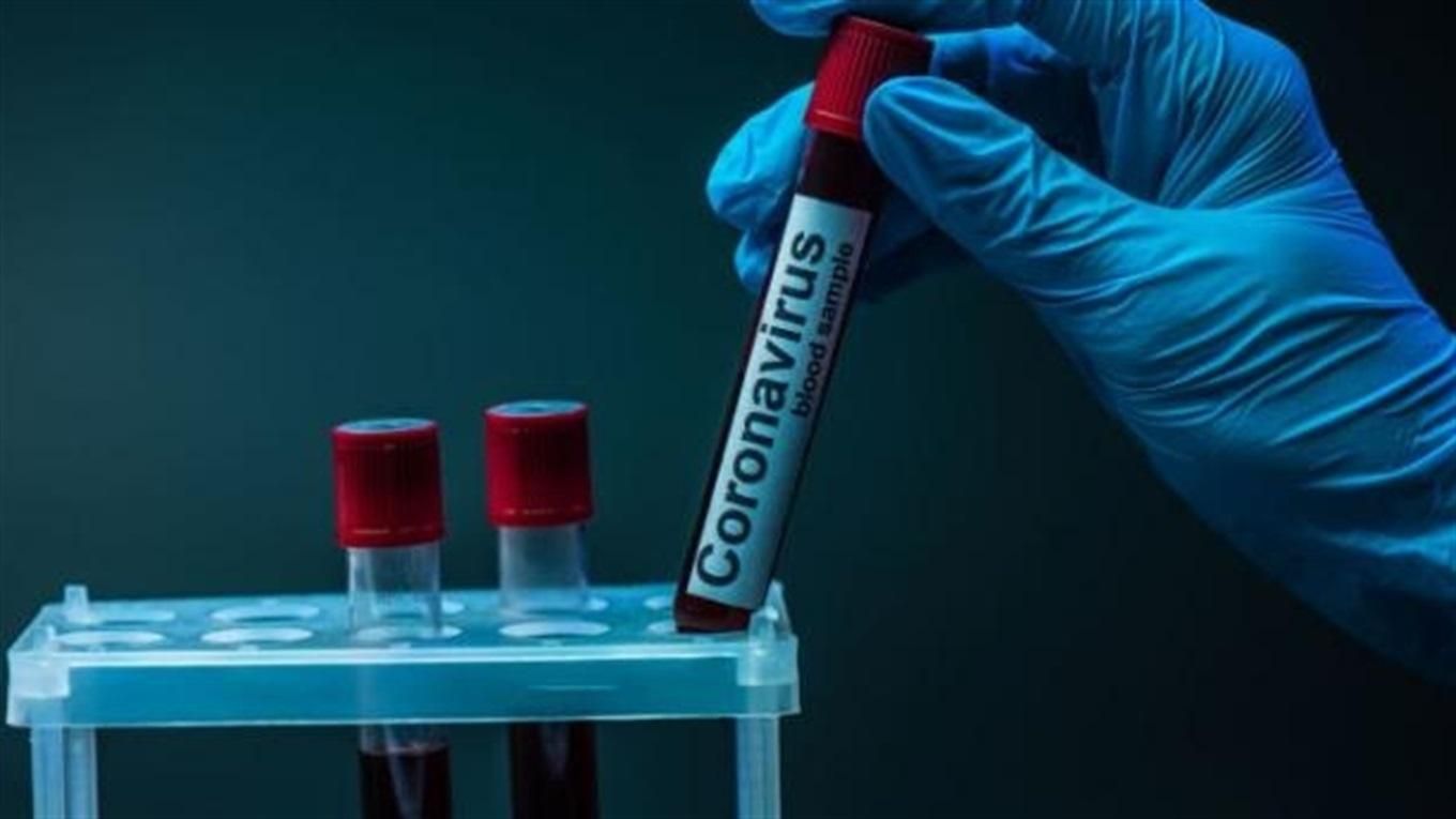 В Украине обнаружили 2 966 случаев коронавируса за сутки