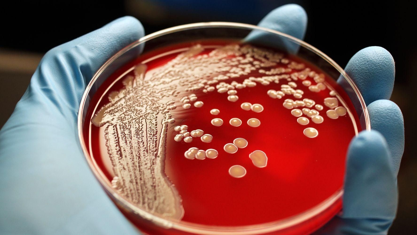 На рівні COVID-19: медики заявили про загрозу нових супербактерій
