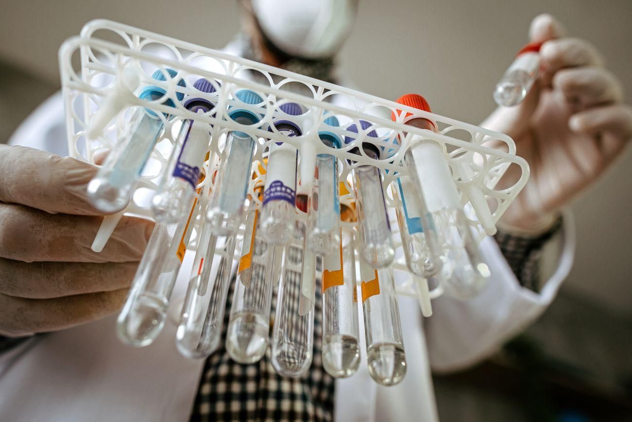 Тест на коронавірус безкоштовно можна робити в приватних лабораторіях, – рішення уряду